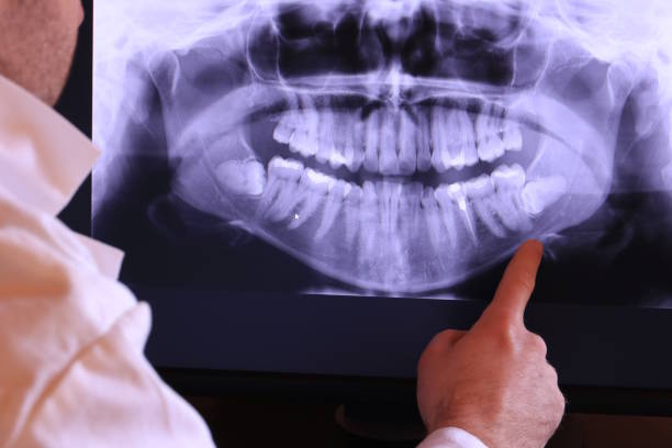 Best Dentist for Severe Toothache  in Williamson, AZ