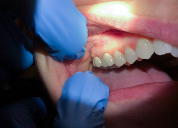 Best Urgent Tooth Repair  in Williamson, AZ